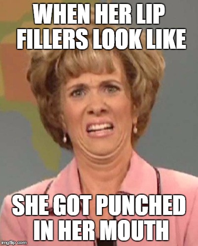 Face Assault  | WHEN HER LIP FILLERS LOOK LIKE; SHE GOT PUNCHED IN HER MOUTH | image tagged in wtfdidyoudo,whyyy,itneverlooksgood | made w/ Imgflip meme maker