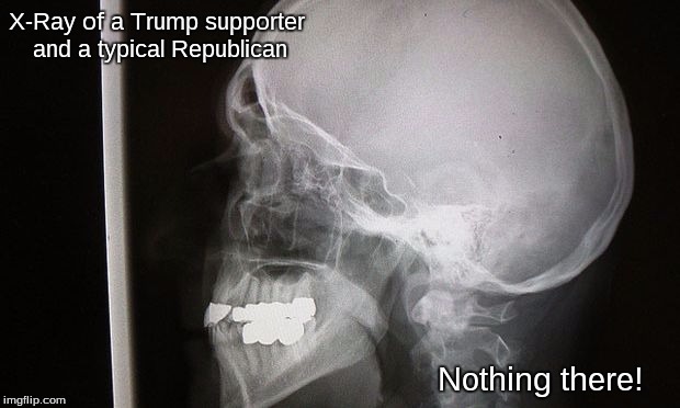 X-Ray of a Trump supporter and a typical Republican; Nothing there! | image tagged in trump supporter,republican | made w/ Imgflip meme maker
