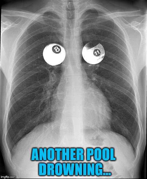 Everyone else was hall right... | ANOTHER POOL DROWNING... | image tagged in memes,xray,pool,sport,medical | made w/ Imgflip meme maker