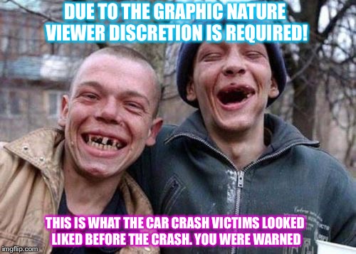 ugly twins | DUE TO THE GRAPHIC NATURE VIEWER DISCRETION IS REQUIRED! THIS IS WHAT THE CAR CRASH VICTIMS LOOKED LIKED BEFORE THE CRASH. YOU WERE WARNED | image tagged in ugly twins | made w/ Imgflip meme maker