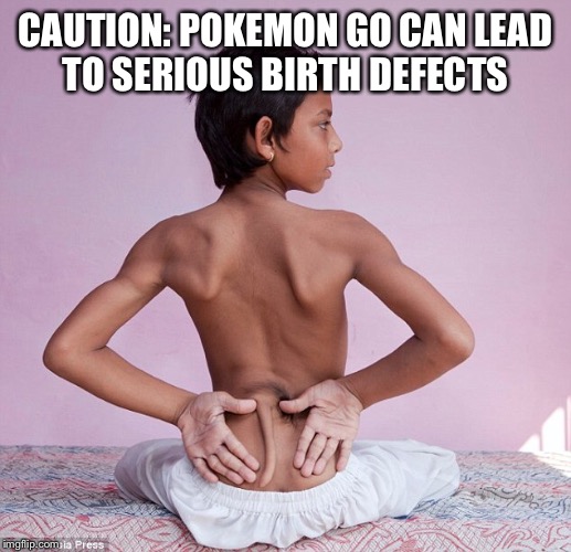 CAUTION: POKEMON GO CAN LEAD TO SERIOUS BIRTH DEFECTS | made w/ Imgflip meme maker