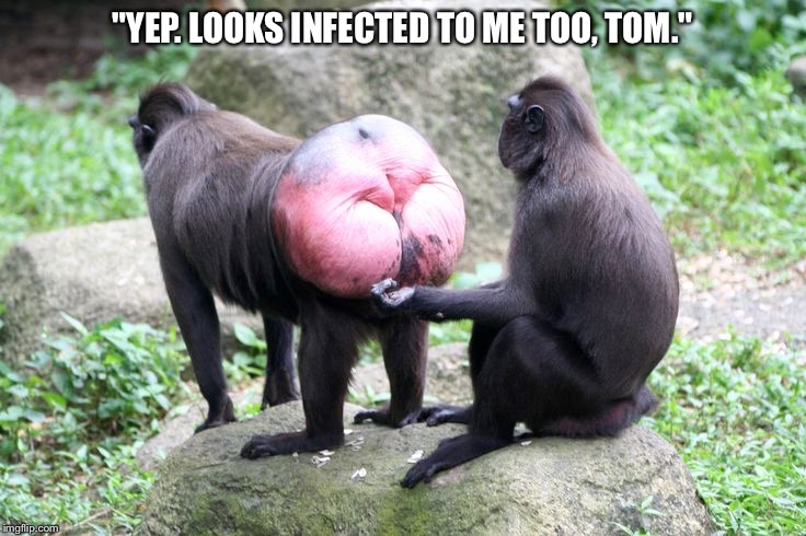 Monkey | "YEP. LOOKS INFECTED TO ME TOO, TOM." | image tagged in monkey,infection,monkeys,monkeyass | made w/ Imgflip meme maker