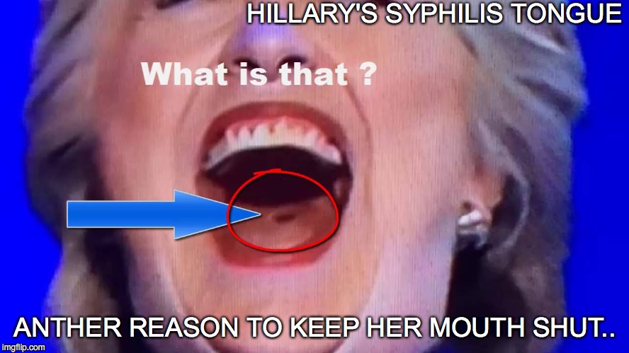 HILLARY'S SYPHILIS TONGUE; ANTHER REASON TO KEEP HER MOUTH SHUT.. | image tagged in wtf hillary | made w/ Imgflip meme maker
