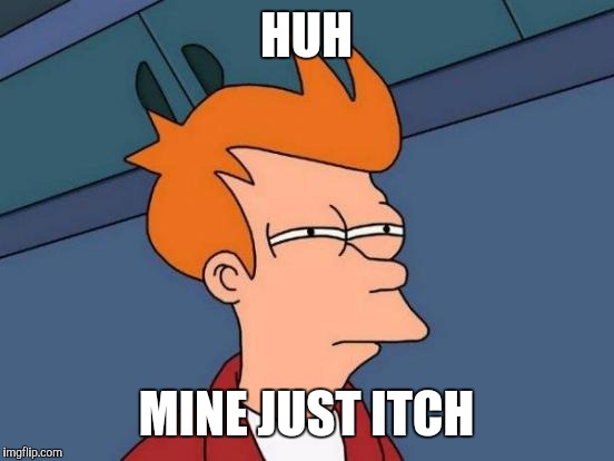 Futurama Fry Meme | HUH MINE JUST ITCH | image tagged in memes,futurama fry | made w/ Imgflip meme maker