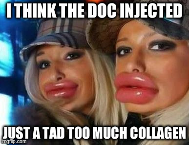 Duck Face Chicks Meme | I THINK THE DOC INJECTED; JUST A TAD TOO MUCH COLLAGEN | image tagged in memes,duck face chicks | made w/ Imgflip meme maker