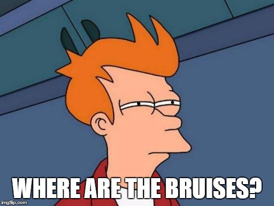 Futurama Fry Meme | WHERE ARE THE BRUISES? | image tagged in memes,futurama fry | made w/ Imgflip meme maker