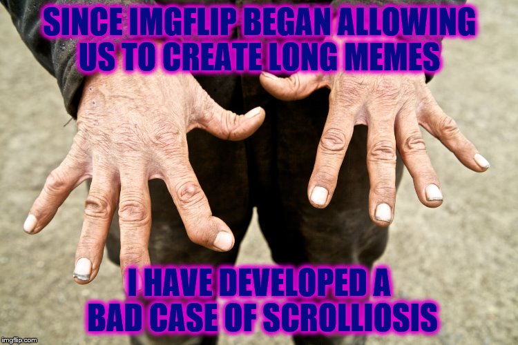also known as "Lynch1979" syndrome, because I would never make a long meme like that :) | SINCE IMGFLIP BEGAN ALLOWING US TO CREATE LONG MEMES; I HAVE DEVELOPED A BAD CASE OF SCROLLIOSIS | image tagged in memes,scrolliosis | made w/ Imgflip meme maker