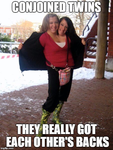 Conjoined Twins | CONJOINED TWINS; THEY REALLY GOT EACH OTHER'S BACKS | image tagged in conjoined twins,twins | made w/ Imgflip meme maker
