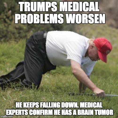 Trumps medical problems worsen | TRUMPS MEDICAL PROBLEMS WORSEN; HE KEEPS FALLING DOWN. MEDICAL EXPERTS CONFIRM HE HAS A BRAIN TUMOR | image tagged in donald trump approves | made w/ Imgflip meme maker