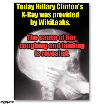Why Hillary's health is deplorable | Today Hillary Clinton's X-Ray was provided by WikiLeaks. The cause of her coughing and fainting is revealed. | image tagged in meme,drsarcasm,hillary clinton,foot in mouth,x-ray,deplorable | made w/ Imgflip meme maker