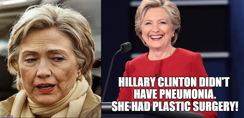 Hillary's Nip Tuck | HILLARY CLINTON DIDN'T HAVE PNEUMONIA. SHE HAD PLASTIC SURGERY! | image tagged in hillary clinton 2016,funny memes,donald trump approves,plastic surgery,scary hillary,hillary clinton pneumonia | made w/ Imgflip meme maker