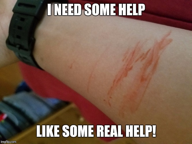 It's fake blood, don't worry lol. Did this in history class with scissors lmao. | I NEED SOME HELP; LIKE SOME REAL HELP! | image tagged in memes,wake me up inside,edgy,fake blood,help me | made w/ Imgflip meme maker