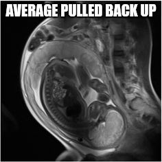 AVERAGE PULLED BACK UP | made w/ Imgflip meme maker