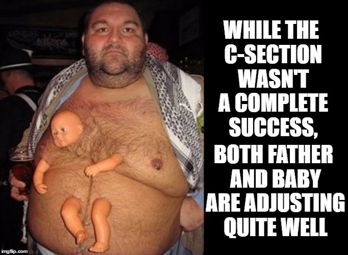 I Sense A Lawsuit Is On Its Way | WHILE THE C-SECTION WASN'T A COMPLETE SUCCESS, BOTH FATHER AND BABY ARE ADJUSTING QUITE WELL | image tagged in meme,baby,father,birth,lawsuit | made w/ Imgflip meme maker
