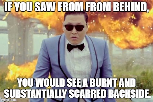Gangnam Style PSY | IF YOU SAW FROM FROM BEHIND, YOU WOULD SEE A BURNT AND SUBSTANTIALLY SCARRED BACKSIDE. | image tagged in memes,gangnam style psy | made w/ Imgflip meme maker