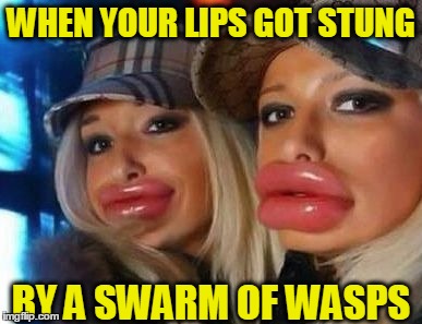 Fuller lips | WHEN YOUR LIPS GOT STUNG; BY A SWARM OF WASPS | image tagged in memes,duck face chicks | made w/ Imgflip meme maker