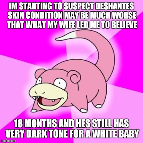 Slowpoke | IM STARTING TO SUSPECT DESHANTES SKIN CONDITION MAY BE MUCH WORSE THAT WHAT MY WIFE LED ME TO BELIEVE; 18 MONTHS AND HES STILL HAS VERY DARK TONE FOR A WHITE BABY | image tagged in memes,slowpoke | made w/ Imgflip meme maker