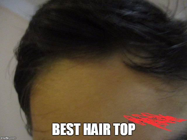 BEST HAIR TOP | image tagged in bad hair day | made w/ Imgflip meme maker