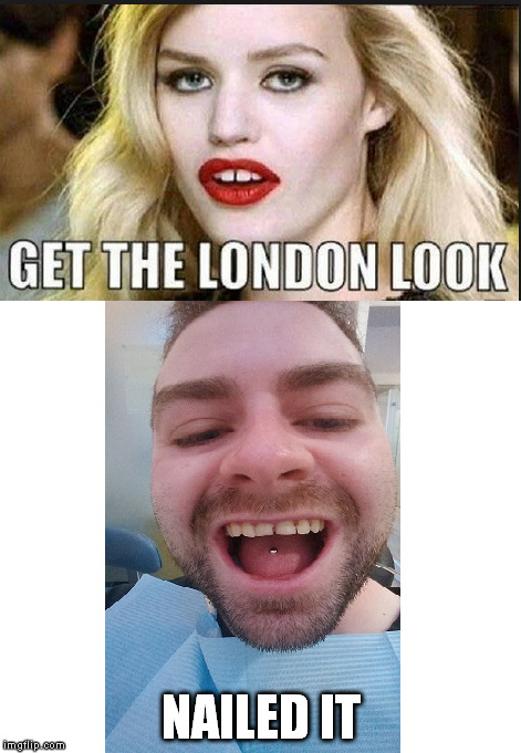 London Look | NAILED IT | image tagged in london,teeth | made w/ Imgflip meme maker