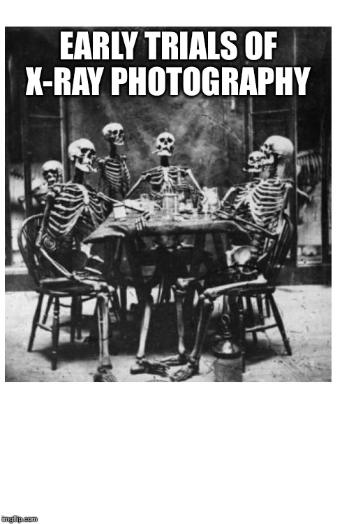 EARLY TRIALS OF X-RAY PHOTOGRAPHY | made w/ Imgflip meme maker