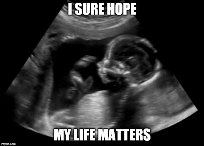 "I've had a lot of time to think in here..." | I SURE HOPE; MY LIFE MATTERS | image tagged in memes,sonogram,all life matters | made w/ Imgflip meme maker