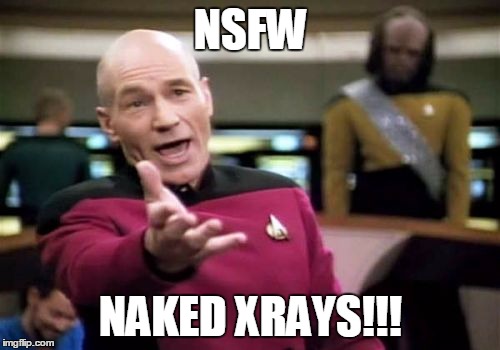Picard Wtf Meme | NSFW NAKED XRAYS!!! | image tagged in memes,picard wtf | made w/ Imgflip meme maker