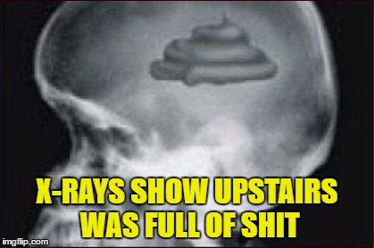X-RAYS SHOW UPSTAIRS WAS FULL OF SHIT | made w/ Imgflip meme maker