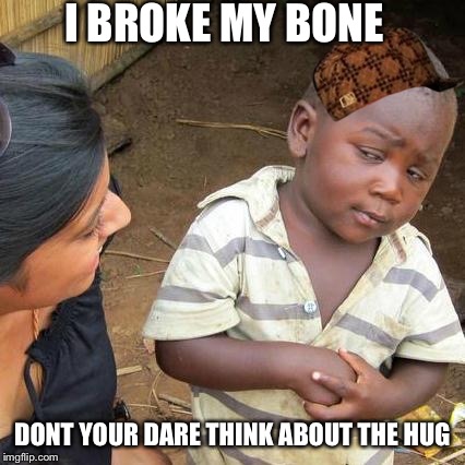 Third World Skeptical Kid | I BROKE MY BONE; DONT YOUR DARE THINK ABOUT THE HUG | image tagged in memes,third world skeptical kid,scumbag | made w/ Imgflip meme maker