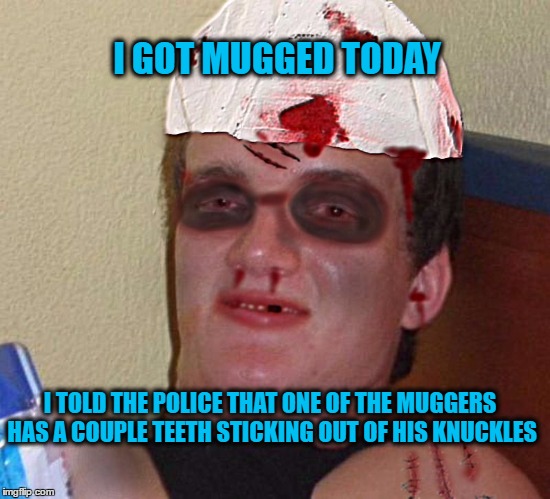 Beat Up 10 Guy | I GOT MUGGED TODAY; I TOLD THE POLICE THAT ONE OF THE MUGGERS HAS A COUPLE TEETH STICKING OUT OF HIS KNUCKLES | image tagged in beat up 10 guy | made w/ Imgflip meme maker