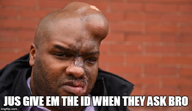 hurt bumps | JUS GIVE EM THE ID WHEN THEY ASK BRO | image tagged in black lives matter | made w/ Imgflip meme maker