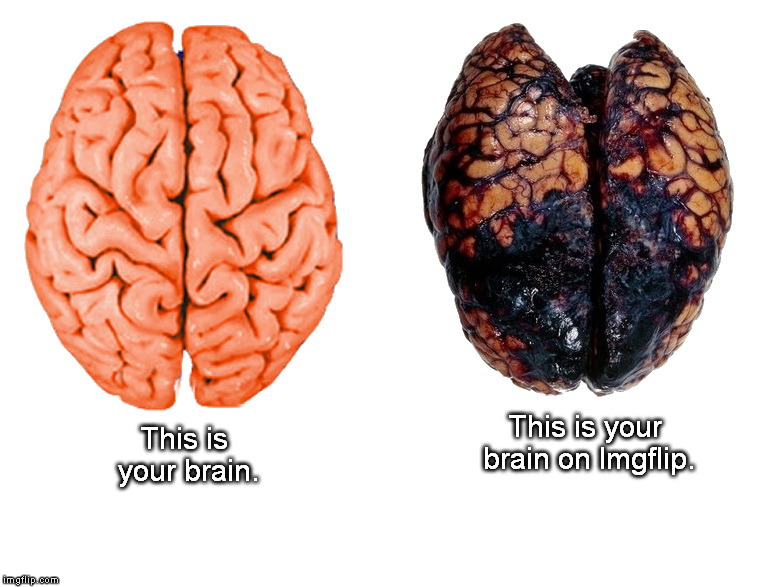 Your Bwain on Memes | This is your brain on Imgflip. This is your brain. | image tagged in brain | made w/ Imgflip meme maker