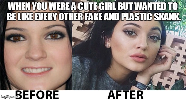 Plastic Skank | WHEN YOU WERE A CUTE GIRL BUT WANTED TO BE LIKE EVERY OTHER FAKE AND PLASTIC SKANK. | image tagged in fake people,plastic surgery,kylie jenner,trash | made w/ Imgflip meme maker