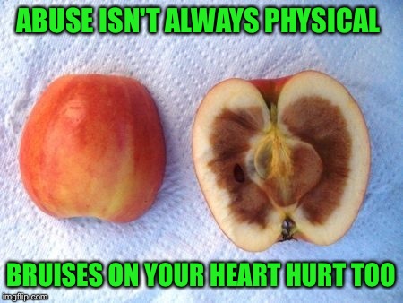 Words Hurt Too  | ABUSE ISN'T ALWAYS PHYSICAL; BRUISES ON YOUR HEART HURT TOO | image tagged in abuse,memes | made w/ Imgflip meme maker