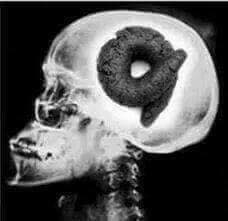 shitbrain Blank Meme Template