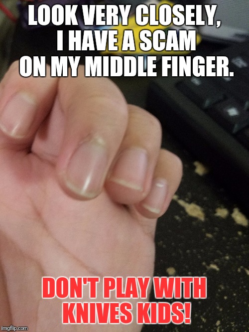 I got my wound last year in November (Hahaha so funny xDD...please kill me) It was pretty big but it healed thankfully!  | LOOK VERY CLOSELY, I HAVE A SCAM ON MY MIDDLE FINGER. DON'T PLAY WITH KNIVES KIDS! | image tagged in memes,hurt,2016,november | made w/ Imgflip meme maker