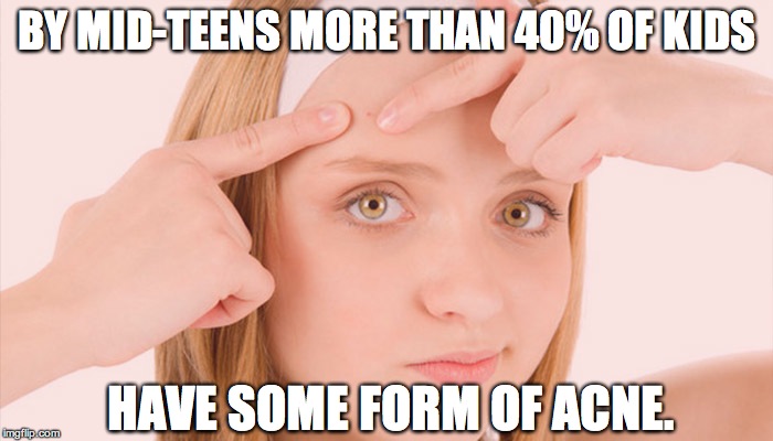 BY MID-TEENS MORE THAN 40% OF KIDS; HAVE SOME FORM OF ACNE. | image tagged in by mid-teens more than 40 of kids have some form of acne | made w/ Imgflip meme maker