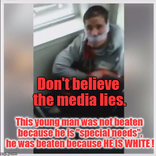 White Hate Crime Victim | Don't believe the media lies. This young man was not beaten because he is "special needs", he was beaten because HE IS WHITE ! | image tagged in white hate crime victim | made w/ Imgflip meme maker