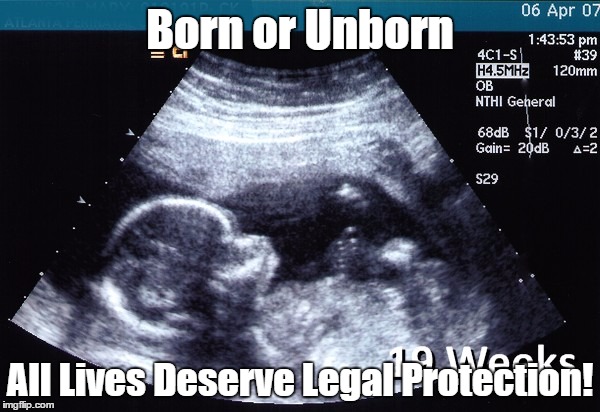 ultrasound |  Born or Unborn; All Lives Deserve Legal Protection! | image tagged in ultrasound | made w/ Imgflip meme maker