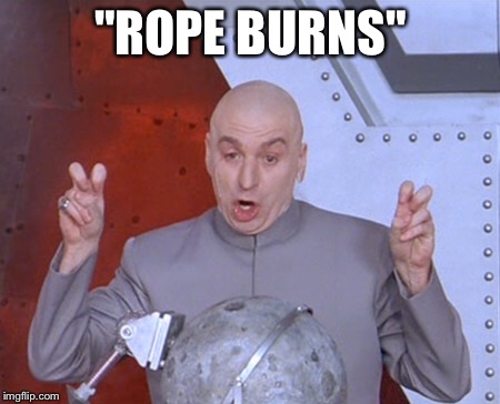 Austin Powers Quotemarks | "ROPE BURNS" | image tagged in austin powers quotemarks | made w/ Imgflip meme maker