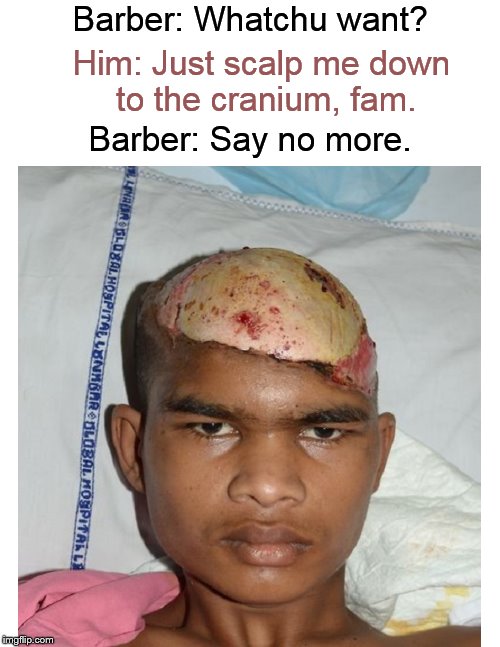 Meanwhile, in the barbershop.... | Barber: Whatchu want? Him: Just scalp me down to the cranium, fam. Barber: Say no more. | image tagged in barber,funny haircuts,bad haircut,haircut,hairstyle,funny memes | made w/ Imgflip meme maker