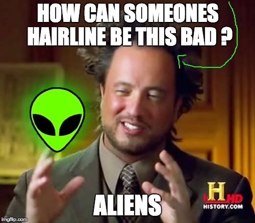 LoL Ancient Aliens | HOW CAN SOMEONES HAIRLINE BE THIS BAD ? ALIENS | image tagged in memes,ancient aliens,lol,funny | made w/ Imgflip meme maker