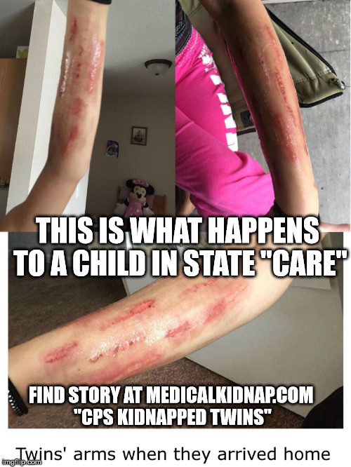 THIS IS WHAT HAPPENS TO A CHILD IN STATE "CARE"; FIND STORY AT MEDICALKIDNAP.COM "CPS KIDNAPPED TWINS" | made w/ Imgflip meme maker