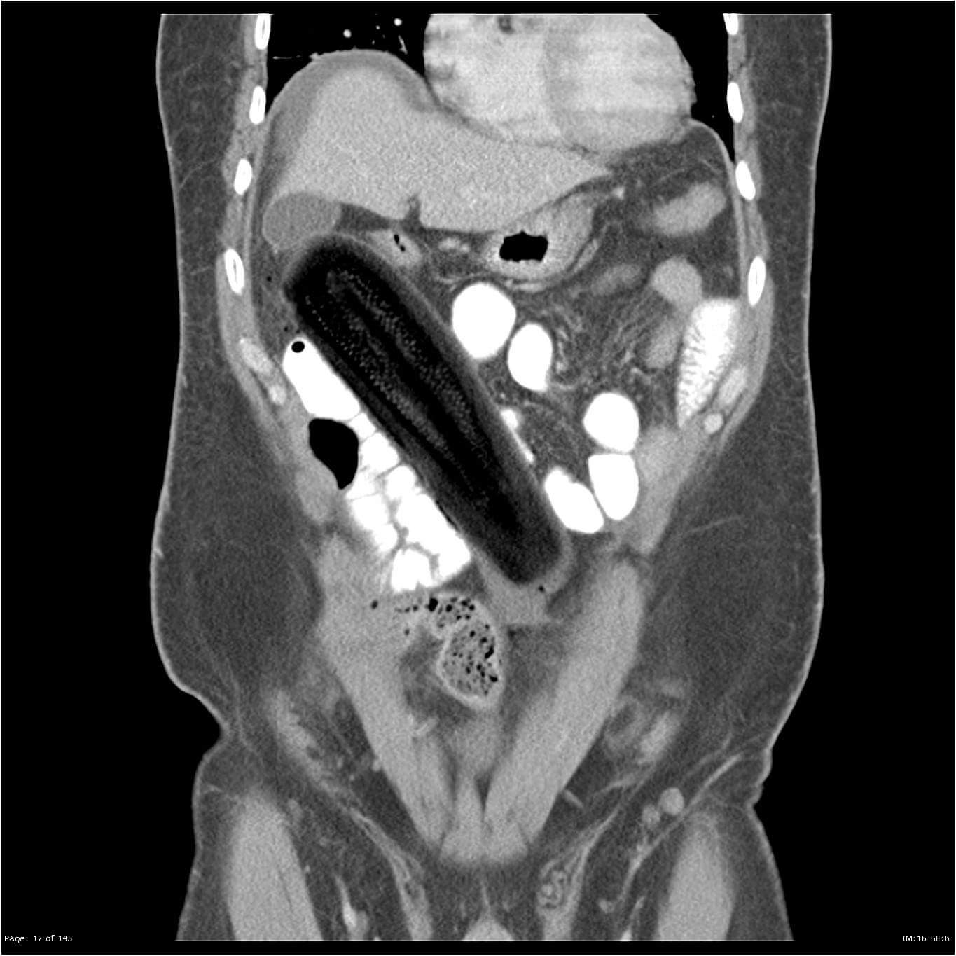 courgette RTG Blank Meme Template