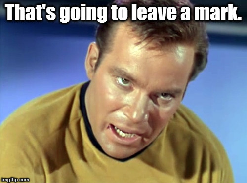 Kirk Rampage | That's going to leave a mark. | image tagged in kirk rampage | made w/ Imgflip meme maker