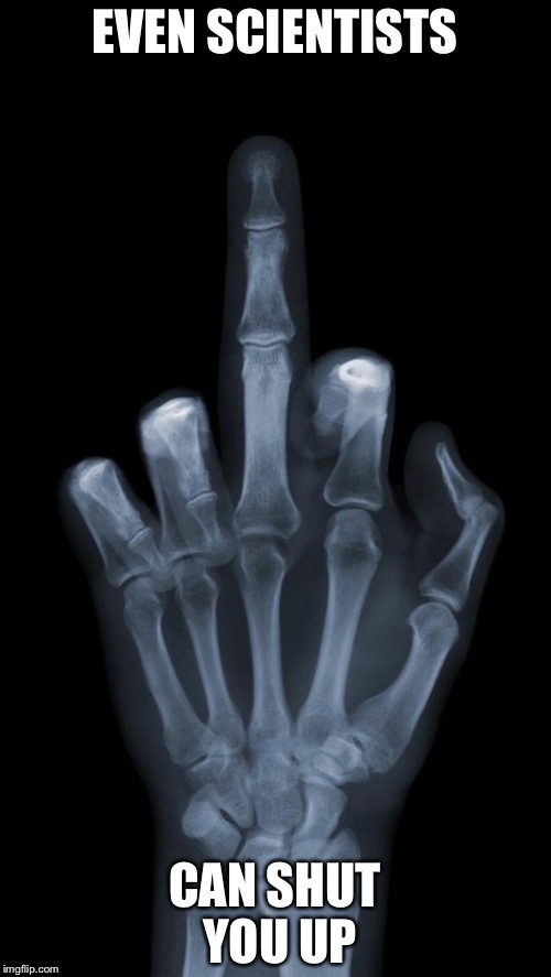 X-Ray Fuck You | EVEN SCIENTISTS; CAN SHUT YOU UP | image tagged in x-ray fuck you | made w/ Imgflip meme maker
