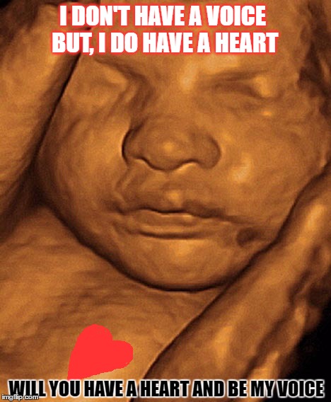 Be My Voice | I DON'T HAVE A VOICE BUT, I DO HAVE A HEART; WILL YOU HAVE A HEART AND BE MY VOICE | image tagged in memes,right to life,choose life,life is a choice,be my voice | made w/ Imgflip meme maker