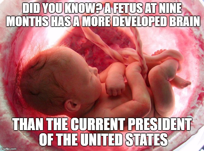 DID YOU KNOW? A FETUS AT NINE MONTHS HAS A MORE DEVELOPED BRAIN; THAN THE CURRENT PRESIDENT OF THE UNITED STATES | image tagged in donald trump,potus,potus45,trump,not my president,trump stupid face | made w/ Imgflip meme maker