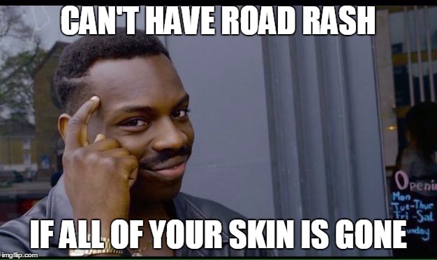 Roll Safe Think About It Meme | CAN'T HAVE ROAD RASH; IF ALL OF YOUR SKIN IS GONE | image tagged in thinking black guy | made w/ Imgflip meme maker