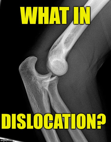 WHAT IN; DISLOCATION? | image tagged in what in tarnation,dislocation,x-ray,what in tarnation week | made w/ Imgflip meme maker