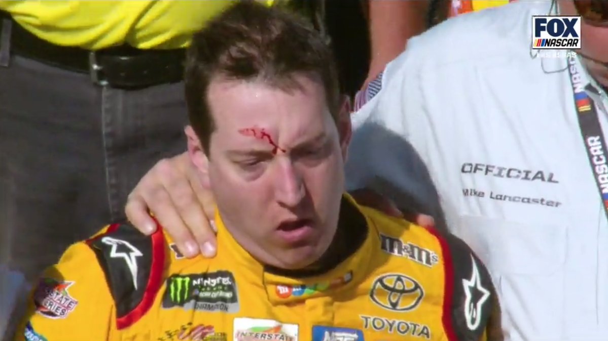 High Quality Kyle Busch Bleeding Blank Meme Template